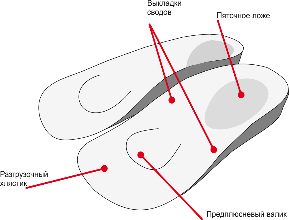 Стелька выкладка свода. Метатарзальный валик. Метатарзальный валик/ валик Зейца. Выкладка свода. Метатарзальный валик продольного свода.